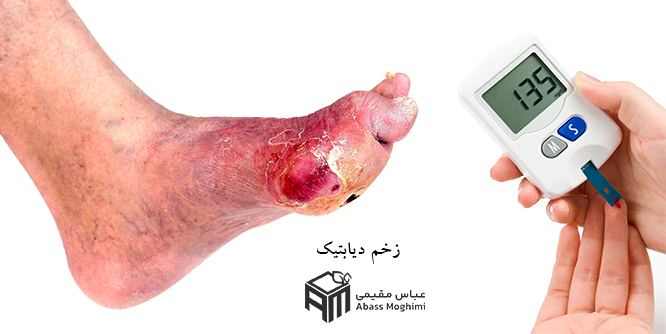 درمان-تخصصی-زخم-پای-دیابتی--کلینیک-زخم-بهبودان